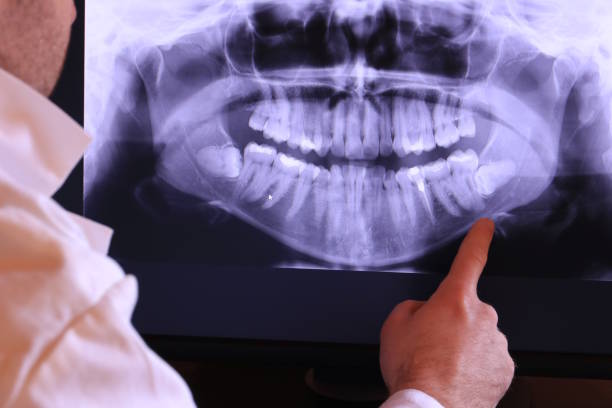 Best Emergency Tooth Extraction in Jefferson, GA