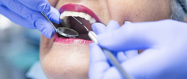 Best Emergency Dental Care for Broken or Chipped Teeth in Jefferson, GA